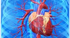 The identification and management of patients with a high risk for cardiac arrhythmias during modified electroconvulsive therapy - ECT-.