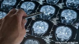 In-depth overview of schizophrenia including symptoms, causes, treatments of schizophrenia. Also resources for schizophrenia patients and family members.
